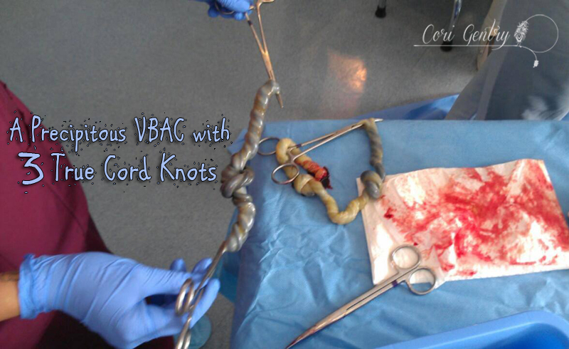 Birth Story / A Precipitous VBAC with 3 True Cord Knots / Ian Raphael